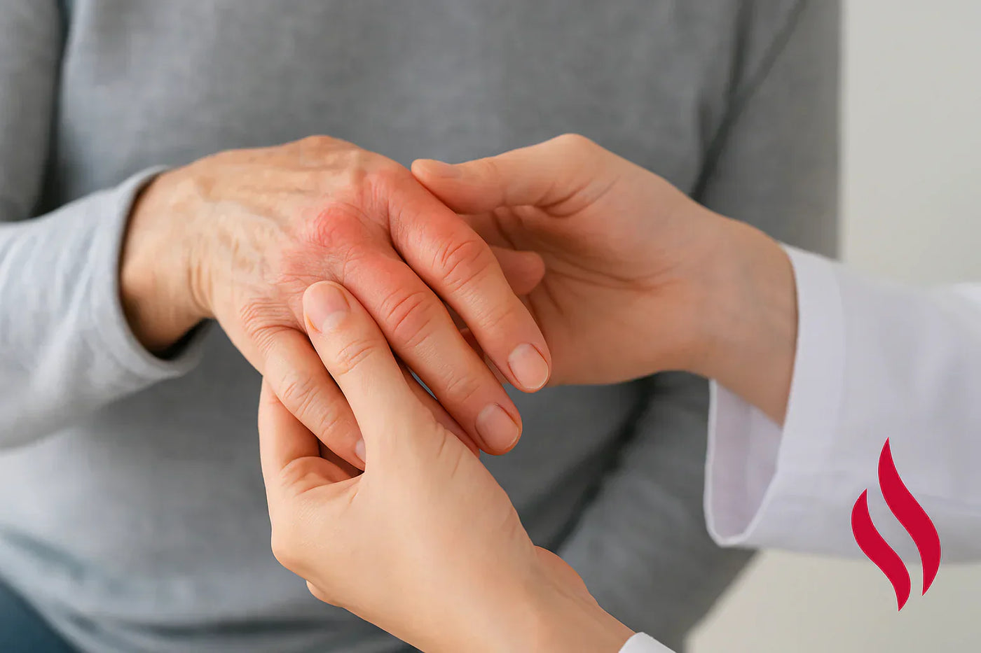 Behandling av gikt i Fingrene - Slitasjegikt, Revmatoid Artritt, Psoriasisartritt m.m.